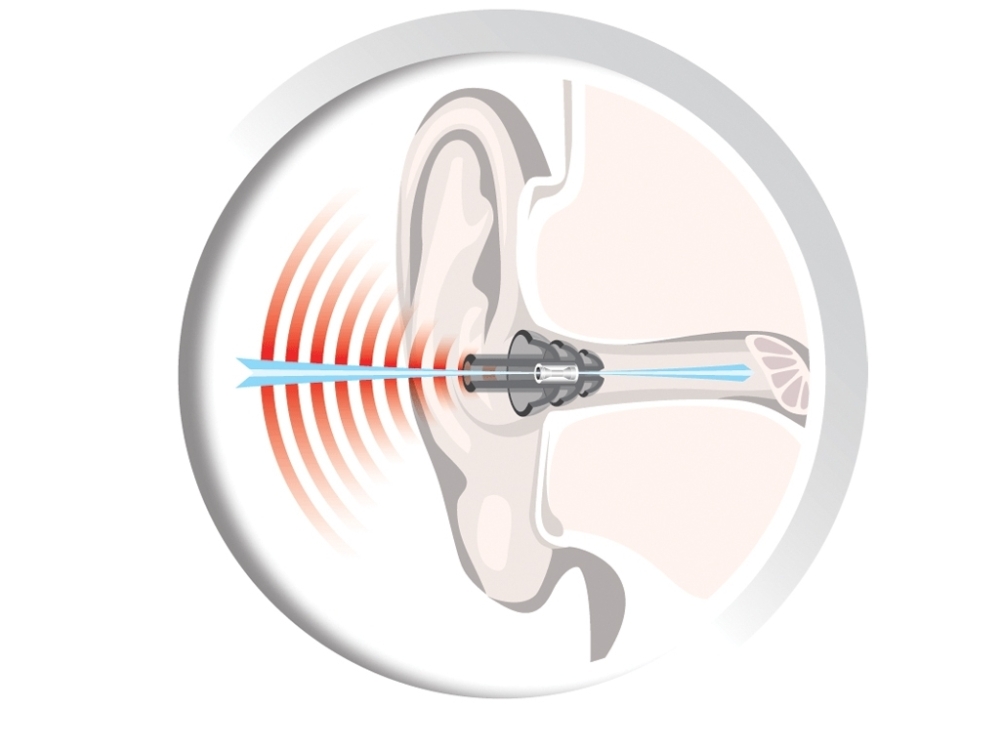 Auritech Shoot Hearing Protector